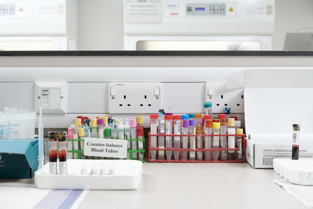 Vials ready to be tested in a hospital laboratory.