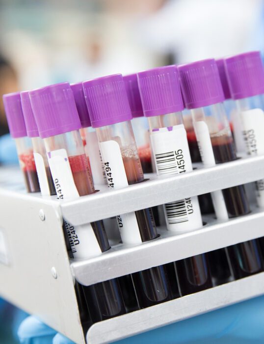 Vials of blood labelled with barcodes.