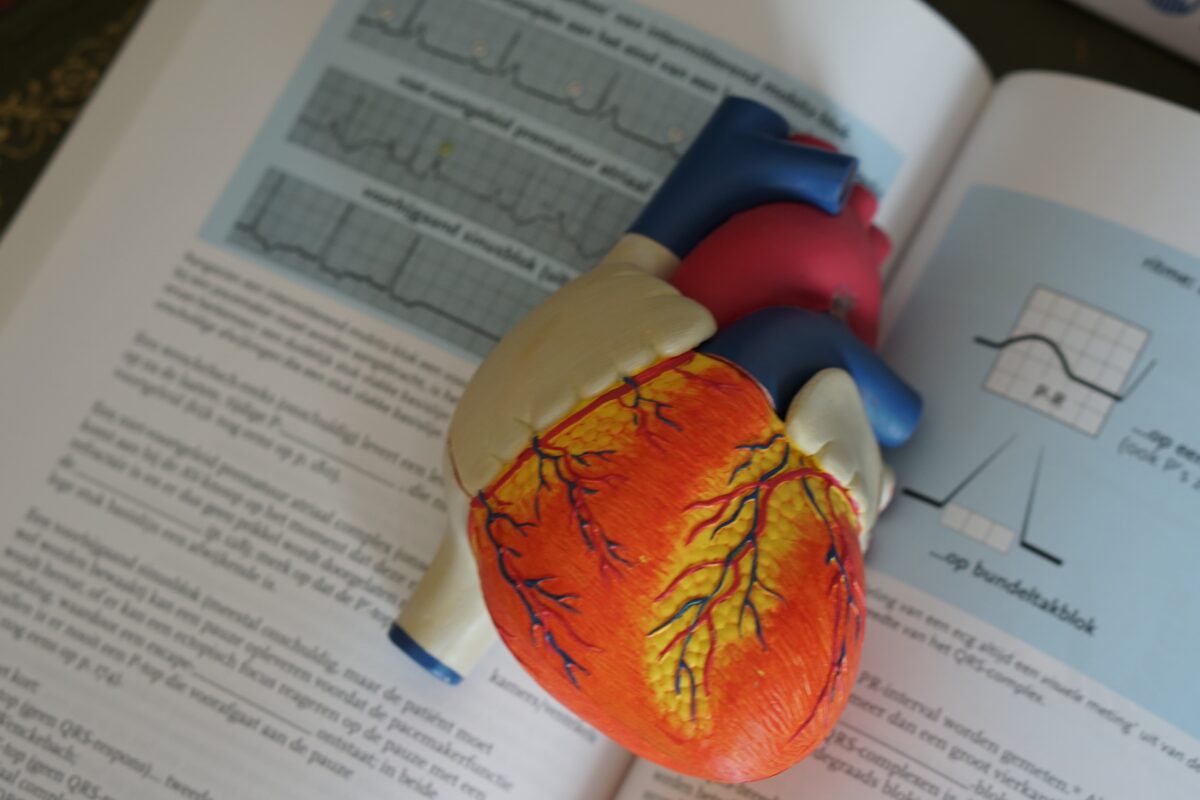 A model of a human heart.