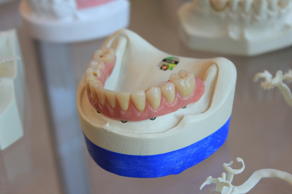 A pair of false teeth in a dental practice